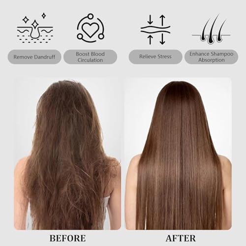 Scalp Massager with Long Handle Hair Growth, Soft Silicone Scalp Scrubber Shampoo Brush for Exfoliation, Dandruff Removal & Head Massage Stress Relax, Wet & Dry Use for Thick, Thin Hair Care