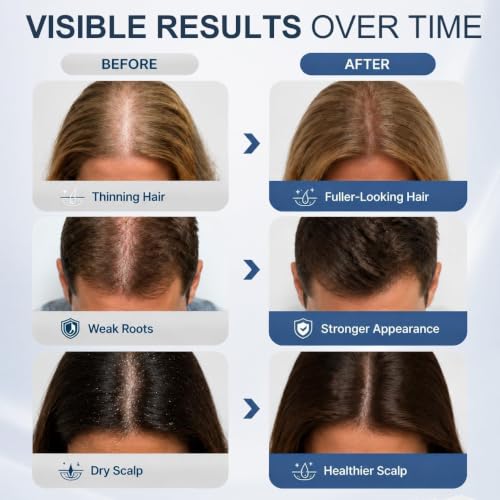 Laser Hair Growth Comb