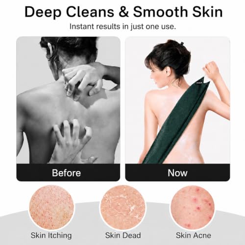 Yiclick Exfoliating Washcloth Towel with Handle, Back Scrubber for Shower, Exfoliating Body Scrubber Exfoliator, Japanese Wash Cloth for Body Scrub, Bath Sponge Loofah Luffa Washer Exfoliator - color: Darkgreen