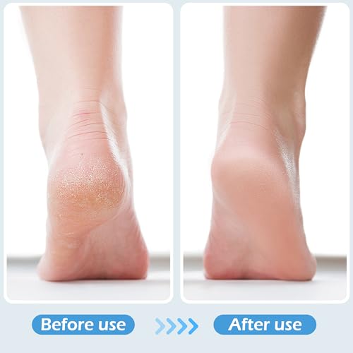 3 Pcs 4 in 1 Foot Brush for Use in Shower with Pumice Stone, Foot Rasp and Sandpaper, Foot Scrubber Brush for Feet, Dead Skin Remover for Foot Care - style: 3 Gray Foot Brush