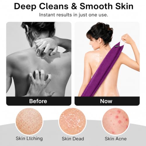 Yiclick Exfoliating Washcloth Towel with Handle, Back Scrubber for Shower, Exfoliating Body Scrubber Exfoliator, Japanese Wash Cloth for Body Scrub, Bath Sponge Loofah Luffa Washer Exfoliator - color: Rose