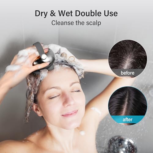 arboleaf Scalp Massager Rechargeable Head Massager Scalp Stress Relax, Waterproof Handheld Hair Scratcher with 8 Removable Massage Claws, Gift for Dad Mom - color: Silver