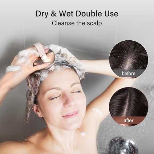 arboleaf Scalp Massager Kneading Head Massager Scalp Stress Relax Portable Rechargeable Hair Massager Shower Massage Waterproof Cat Massager Scratcher,Gift for Mom Dad - color: Rose Pink