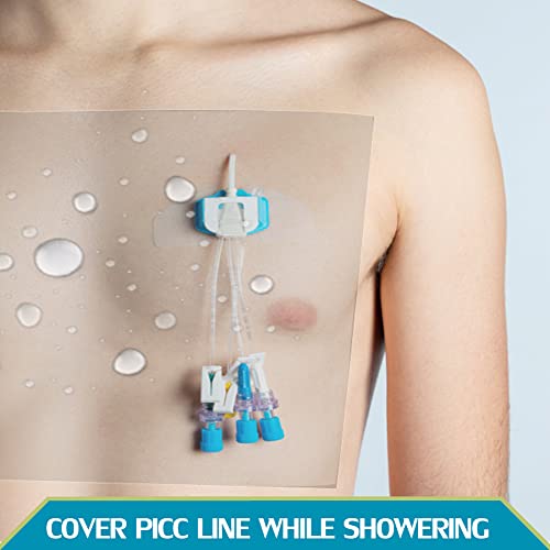 Waterproof Dialysis Catheter Shower Cover Large Coverage Shields for Peritoneal Dialysis Port Accessories PD Chest Catheter Central PICC Line Feeding Tube 9"x9"(Pack of 25) - size: 9 x 9 Inch (Pack of 25)