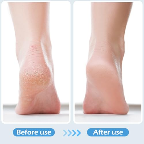 2 Pcs 4 in 1 Foot Brush for Use in Shower with Pumice Stone, Foot Rasp and Sandpaper, Foot Scrubber Brush for Feet, Dead Skin Remover for Foot Care - style: 2 Black Gray Foot Brush