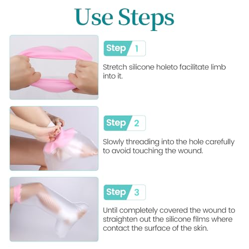 Waterproof Cast Covers for Shower Leg, Knee Surgery Recovery Equipment, Cast Protector for Showering Leg Adult Wounds, Cast Cover Leg Adult After Surgery, Shower Boot Cover Waterproof Foot, Reusable - color: Leg, style: Soft Pink