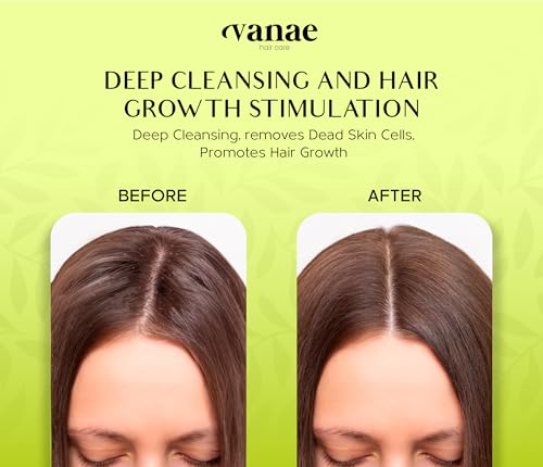 Vanae Shampoo Brush - Scalp Massager Hair Growth, Ergonomic Scalp Scrubber, Silica and ABS Brush for All Hair Types, Promotes Blood Circulation, Reduces Dandruff, Eco Responsible, Antimicrobial