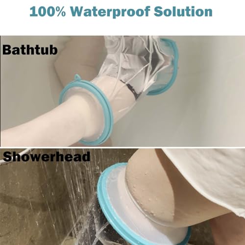 Cast Covers for Shower Leg, Waterproof Cast Cover for Showering, Knee Surgery Recovery Equipment, Waterproof Knee Brace, Knee (Diameter - 7.9") - color: Knee, style: Reinforced Green