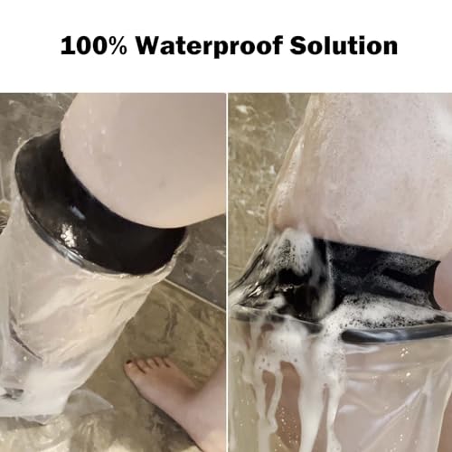 Cast Covers for Shower Leg, Waterproof Cast Cover for Showering, Cast Protector for Shower Leg Adult, Shower Boots for Foot After Surgery, Knee, Ankle, Foot (Diameter - 7.9") - color: Leg, style: Soft Black
