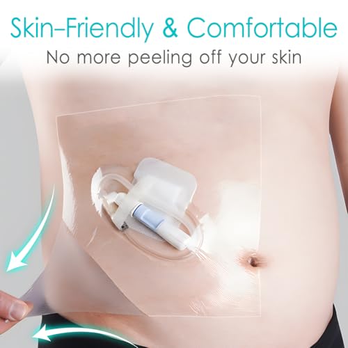 Waterproof Dialysis Catheter Shower Cover Large Coverage Shields for Peritoneal Dialysis Port Accessories PD Chest Catheter Central PICC Line Feeding Tube 10"x10"(Pack of 25) - size: 10 x 10 Inch (Pack of 25)