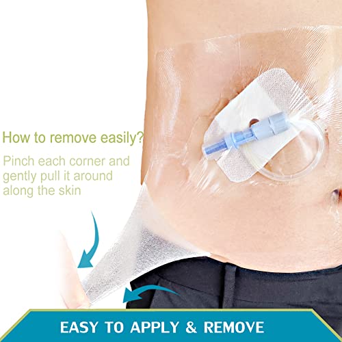 Waterproof Dialysis Catheter Shower Cover PD Catheter Shower Protector Shields with Non-Stick Center Pad for Peritoneal Dialysis Accessories Port Chest Central Line 8"x8" Pack of 25 - size: 8 x 8" with Island Dressing (Pack of 25)