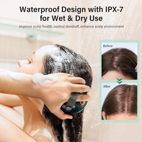 arboleaf Scalp Massager Electric, Portable Head Massager Scalp Stress Relax, Waterproof 6 in 1 Hair Massage with 8 Removable Claws, Rechargeable Hair Head Scratcher, Gift for Dad Mom - color: Teal Black