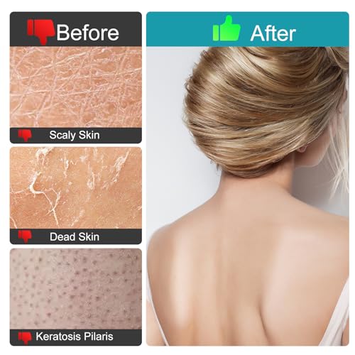Exfoliating Gloves, (4pcs) Durable Body Scrub, Dead Skin Remover & Body Scrubber Exfoliator, Body Exfoliating Gloves for Shower, washcloth exfoliating, exfoliating Glove for Smooth Skin