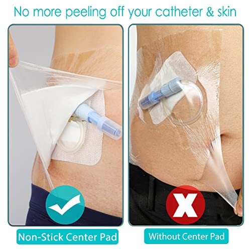 Waterproof Shower Protector Large Cover Shields for PICC Central Line Peritoneal Dialysis Chest Port Feeding Tube PD Catheter Accessories Bandages with Non-Stick Center Pad 12"x14"(Pack of 14) - size: 12 x 14" with Island Dressing (Pack of 14)