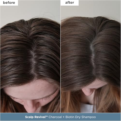 Briogeo Scalp Revival Scalp Care Essentials Set | Detox & Hydrate Your Scalp with Charcoal- + Tea Tree-Infused Treatments | Vegan & Cruelty Free