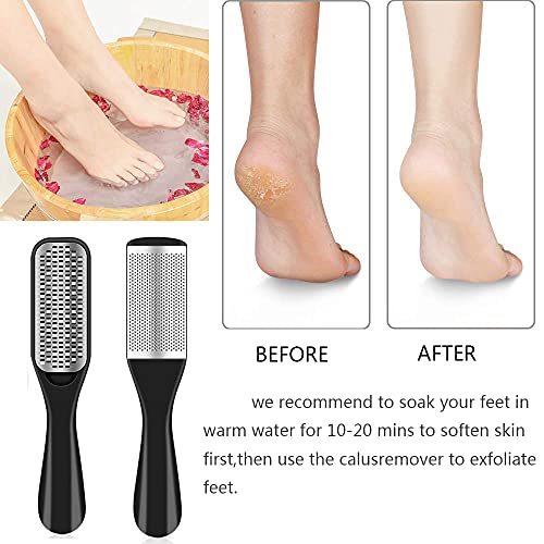 36 in 1 Pedicure Kit, Professional Pedicure Tools Foot Rasp Foot Dead Skin Remover for Home & Salon Care - style: Black