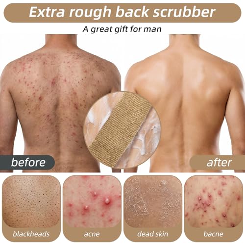 2 Pack Exfoliating Back Scrubber for Shower, Extra Rough Exfoliating Washcloth Towel and Shower Bath Glove, Natural Body Exfoliator, Deep Clean Back Scrubber Spa Tool for Glowing Skin