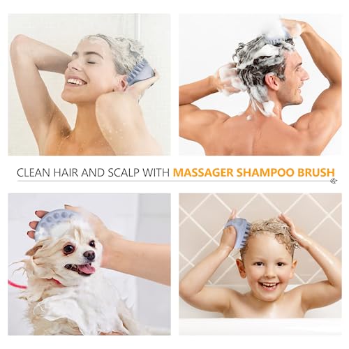 Sndyi Scalp Massager Shampoo Brush, Scalp Scrubber with Soft Silicone Bristles, Scalp Exfoliator for Dandruff Removal, Scalp Massager for Hair Growth, Wet Dry Hair Brush for Scalp Care, Sky Blue - color: Sky Blue