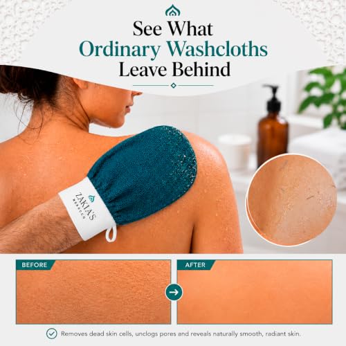 Kessa Exfoliating Mitt – Teal for Radiant Skin | Microdermabrasion, Removes dead skin, dirt and grime, spray tan removal - color: Teal Blue, size: 1 Count (Pack of 1)