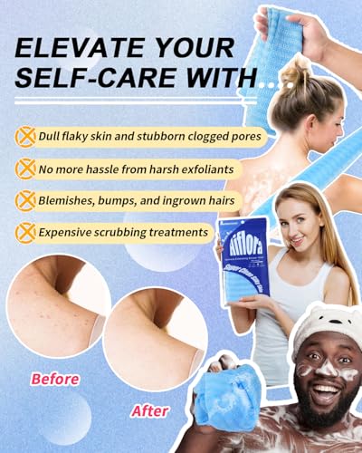 3 Pack Back Exfoliator for Shower and Dead Skin Removal, Exfoliating Body Scrubber for Smooth Skin Japan Washcloth for Shower & Bath, Versatile Body Scrub Towel - style: Gentle + Medium + Deep