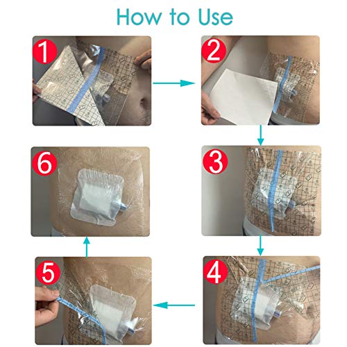 Waterproof Dialysis Catheter Shower Cover Large Coverage Shields for Peritoneal Dialysis Port Accessories PD Chest Catheter Central PICC Line Feeding Tube 10"x10"(Pack of 25) - size: 10 x 10 Inch (Pack of 25)