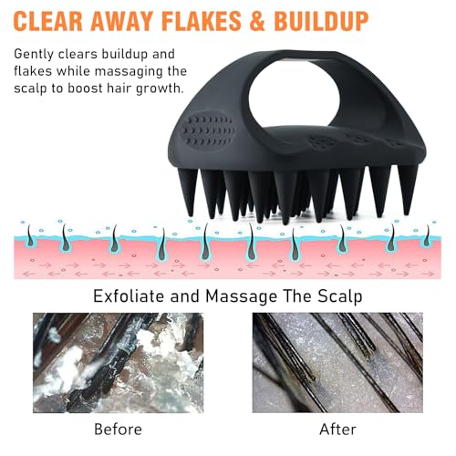 YEALIR Scalp Massager Shampoo Brush, Scalp Scrubber for Dandruff & Build Up, Scalp Massager Hair Growth - 100% Silicone, Plastic Free