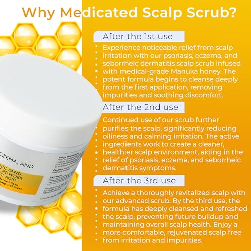 Anti Fungal Pre Shampoo Scalp Scrub for Psoriasis, Eczema & Seborrheic Dermatitis | DHT Blockers, Mineral Complex & Tea Tree Oil | Clears Buildup, Soothes Scalp and Promotes Hair Growth 7.7 Fl Oz