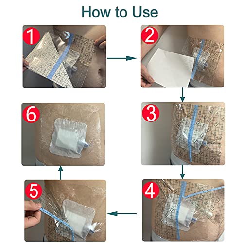 Waterproof Shower Protector Large Cover Shields with Non-Stick Center Pad for PICC Central Line Peritoneal Dialysis Chest Port Feeding Tube PD Catheter Accessories Bandages Women Men 9"x9"(Pack of 25) - size: 9 x 9" with Island Dressing (Pack of 25)