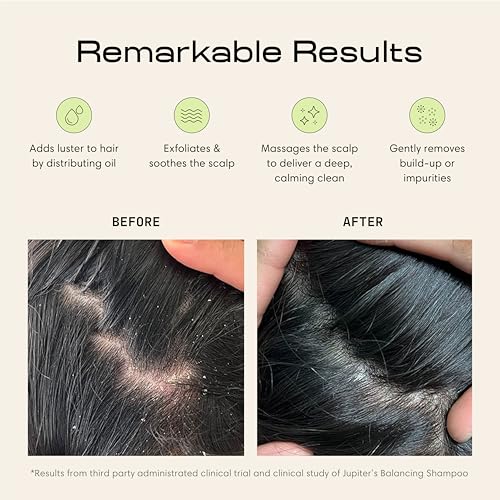 Jupiter Scalp Exfoliator - Scalp Massager Tool for Wet & Dry Hair - Ergonomic Detangler Brush - Dandruff Comb & Scrub to Remove Dandruff & Buildup and Support Circulation - Black - color: Double Black 1 Pack