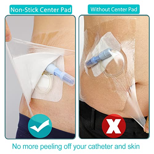 Waterproof Dialysis Catheter Shower Cover PD Catheter Shower Protector Shields with Non-Stick Center Pad for Peritoneal Dialysis Accessories Port Chest Central Line 6"x6" Pack of 25 - size: 6 x 6" with Island Dressing (Pack of 25)
