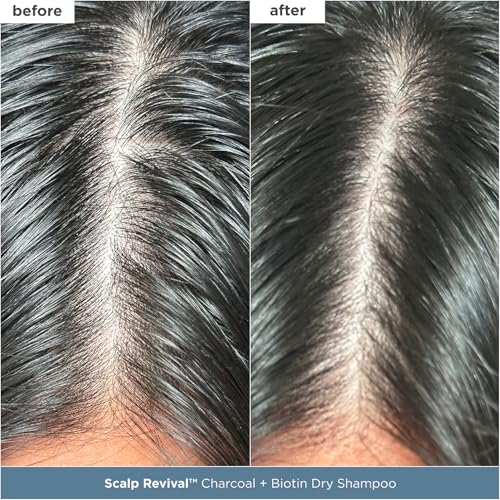 Briogeo Scalp Revival Scalp Care Essentials Set | Detox & Hydrate Your Scalp with Charcoal- + Tea Tree-Infused Treatments | Vegan & Cruelty Free