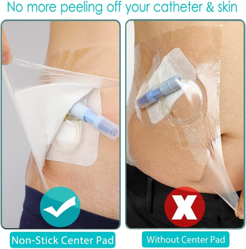 Waterproof Catheter Shower Cover,Shower Protector Dialysis Catheter Pd Picc Line Shower Cover Wound Bandage,Bathing Water Barrier Protector Non Adhesive Dressing (25pcs) (6 x 6 Inch) - size: 6 x 6 Inch